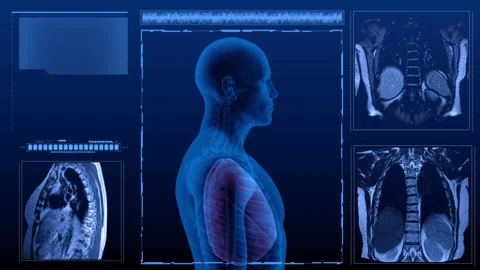 Respiratory Lungs MRI multi Stock Footage 258049823