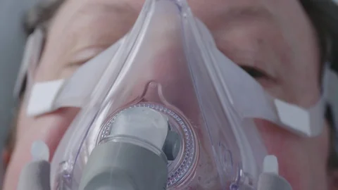 Respiratory problem CPAP Ventilator Mask on mature (50's) Male Patient 動画素材 127929606