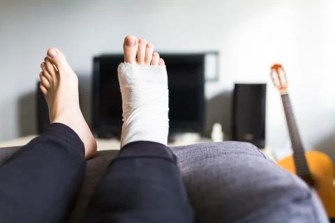 Resting with a broken leg at home Stock Photos