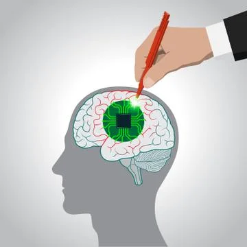 Restoration of brain functions, prosthetics of affected areas, mind, memory Stock Illustration