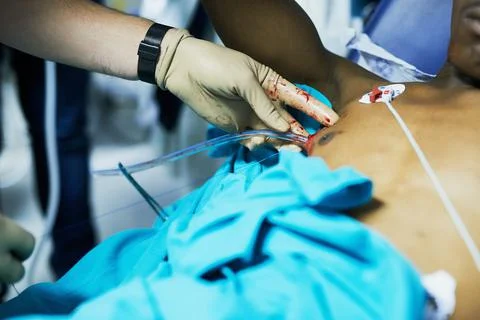 Restoring respiratory function with chest drainage. Cropped shot of a doctor  Stock Photos