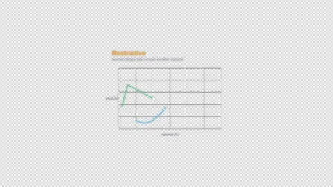 Restrictive Spirometry Flow Volume Loop Animation Labeled Video Overlay Alpha 4K Видео 339302292