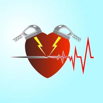 Resuscitation with the help of a difibrillator Illustrazione stock
