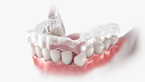 Retiner 動画素材 139956095