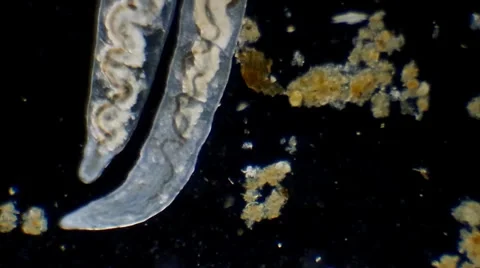 Revealing its innards, a tiny worm appears huge under the microscope Video stock 36705526
