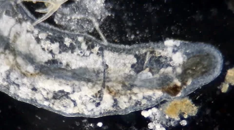 Revealing its innards, a tiny worm appears huge under the microscope Video stock 36705544