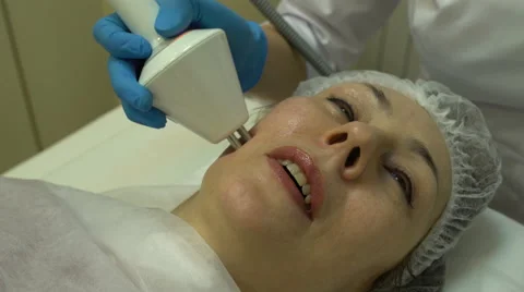 Rf-lifting procedure on a woman's face Stock Footage 60672267