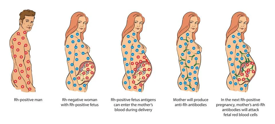 Rh factor Stock Illustration