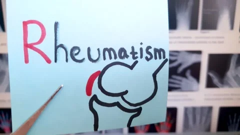 Rheumatism text, note caption. Medical treatment concepts for rheumatism Stock Footage 317549276