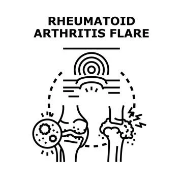 Rheumatoid arthritis flare causing joint inflammation and pain Stock Illustration