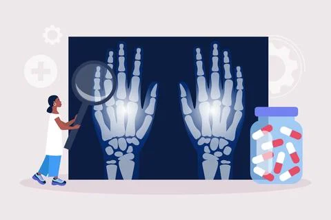 Rheumatology concept Stock Illustration