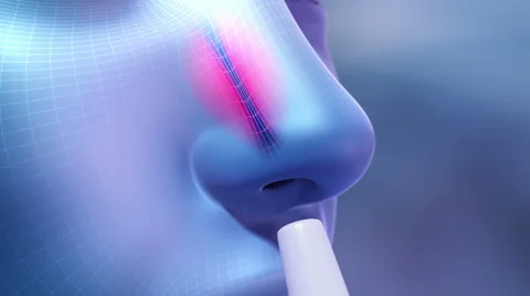 Rhinitis Demo Stock Footage 38475289