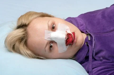 Rhinoplasty. Stock Photos