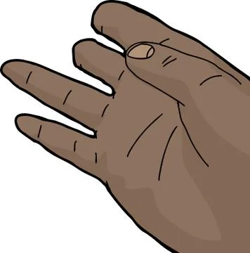 Right Hand with Missing Fingers Stock Illustration
