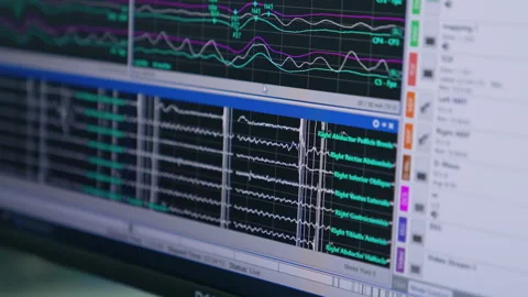 Right lower corner of computer screen with ECG graphics on 库存影片 254928054