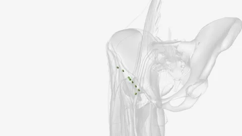 Right superficial inguinal lymph nodes Stock Footage 247262493