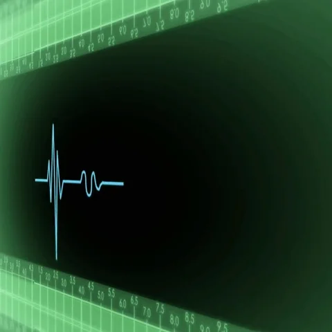 Right View - Dark Screen - monitor - heartbeat line - green Stock Footage