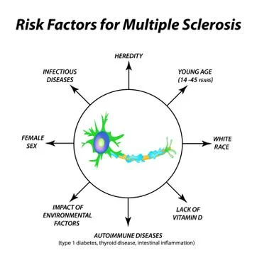 Risk factors for multiple sclerosis. The destruction of the myelin sheath on the Stock Illustration
