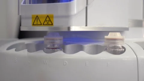 Robot in medicine. Automatic retrieval of analysis results. Mixing different Stock Footage 111962592