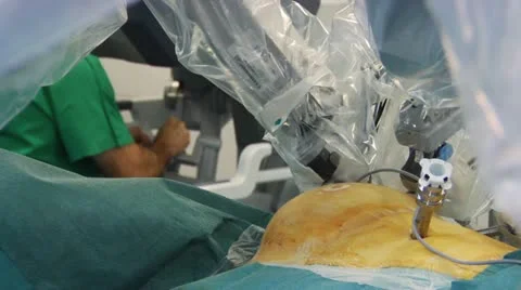 Robot surgeon Vídeos de archivo 10915310