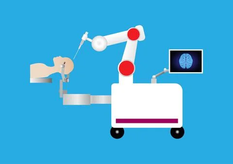 Robotic assisted surgery for brain operation 스톡 일러스트