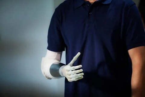 Robotic prosthesis Man equipped with a robotic arm prosthesis. Copyright: ... Stock Photos