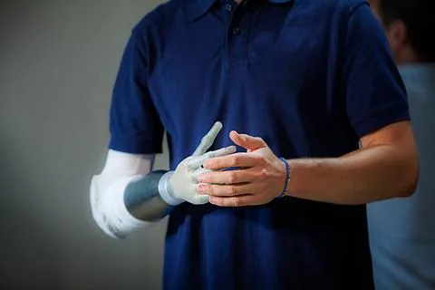Robotic prosthesis Man equipped with a robotic arm prosthesis. Copyright: ... Stock Photos