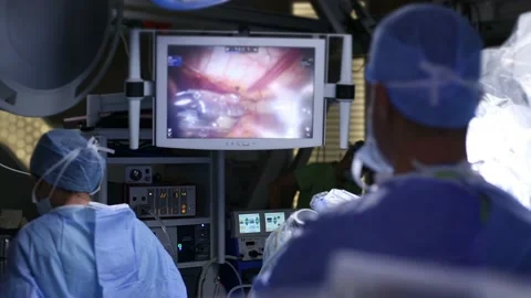 In the robotic surgery operating room. Robotic surgery. Vídeo Stock 236416174