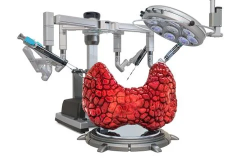 Robotic surgery of the thyroid concept, 3D rendering Stock Illustration