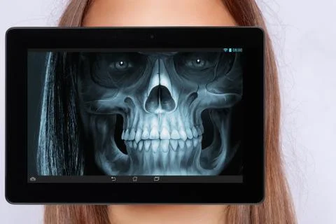 Roengen screening of the face with a tablett Stock Photos