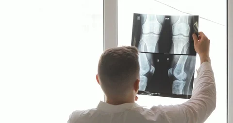 Roentgenologist is learning bones on x-ray images standing near the window, back Stock Footage 108021142