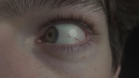 Rolling healty eyeball in slowmotion macro eye wide angle closeup Stock Footage 124014255