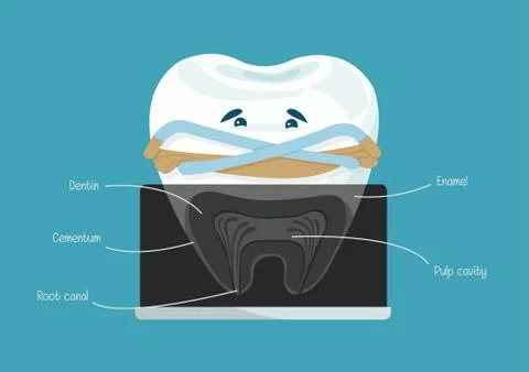 Root canal dental vector Illustrazione stock