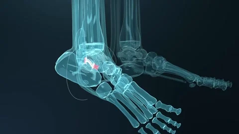 Rotating feet rendering revealing left heel on dark teal studio, showing red Vídeos de archivo 346154900