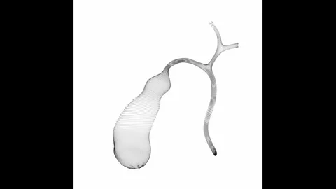 Rotating Gallbladder Minimalistic Wireframe Endless Loop 4K 60FPS Stock Footage 308382106