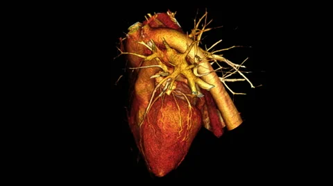 Rotating Heart, CT Scan Video stock 64800376