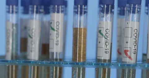 Rotating test tubes containing COVID-19 fluids Stock Footage 127652263