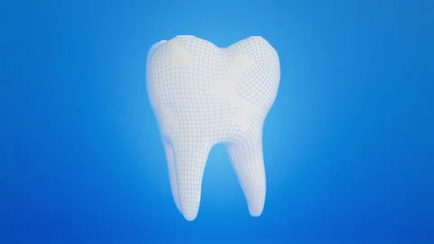 Rotating white tooth, being scanned and covered with lattice. Dental science Stock Footage 337952370