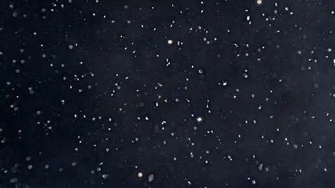 Rotating zoom-out of sperm cells seen through a phase contrast microscope. Stock Footage 252786033
