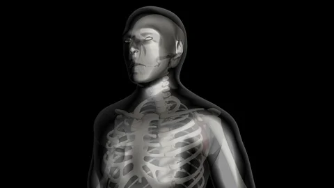 Rotator Cuff Tear 스톡 동영상 121662592