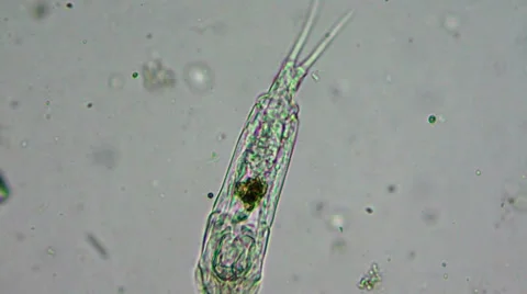 Rotatoria motion under microscope Stock-Footage 33661240