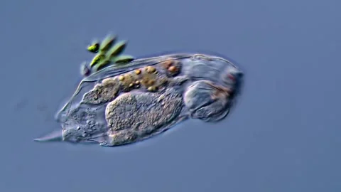 Rotifer (400x magnification) Vídeos de archivo 310312860