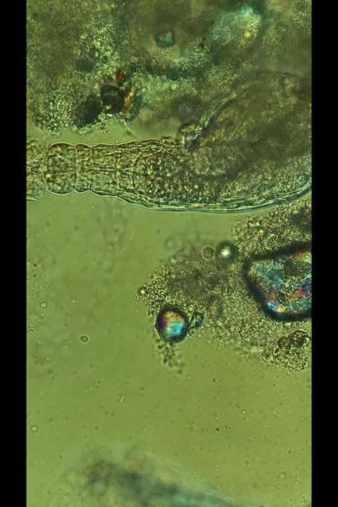 Rotifer at 50x Under Polarized Light Microscopy Stock Footage 335086302