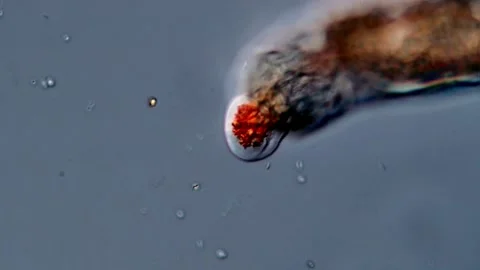 Rotifer, amoeba under microscope 库存影片 310647745
