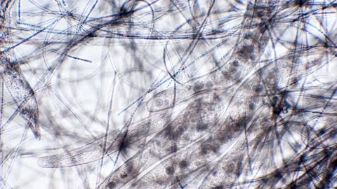 Rotifer and cyanobacteria under the microscope, pond, swamp, water, Stock Footage 226540627