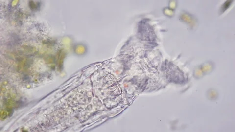 Rotifer colony under microscope. Stunning micro world with lot of microorganisms Stock Footage 157853044