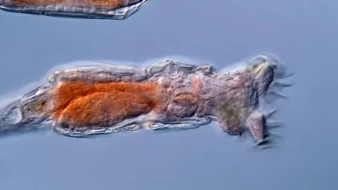 Rotifer colony under microscopy view, 400x magnification 库存影片 310309990