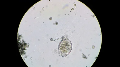 Rotifer dead body being decomposed by bacteria cluster Stock-Footage 122108101
