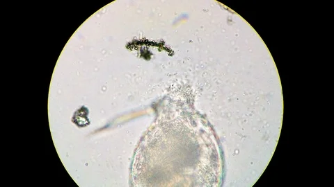 Rotifer dead body being decomposed by bacteria cluster Stock-Footage 122108127