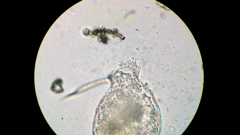 Rotifer dead body being decomposed by bacteria cluster 動画素材 122108205